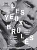 Les Yeux brûlés