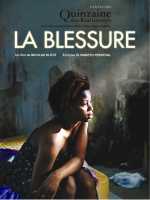 voir la fiche complète du film : La Blessure