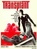 voir la fiche complète du film : The Amazing Transplant