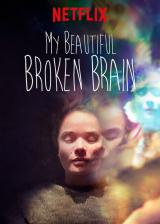 voir la fiche complète du film : My beautiful broken brain
