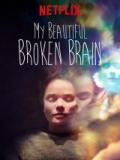 voir la fiche complète du film : My beautiful broken brain